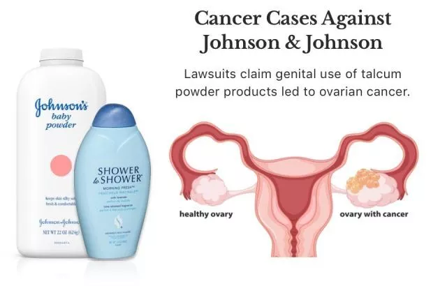 Talcum powder litigation